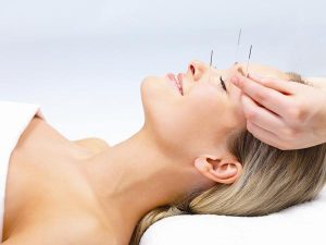 acupuncturefacial 1